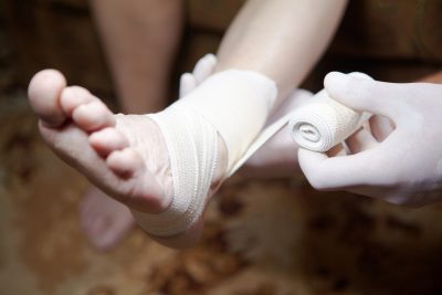 Ankle Sprain Treatment in Woodside