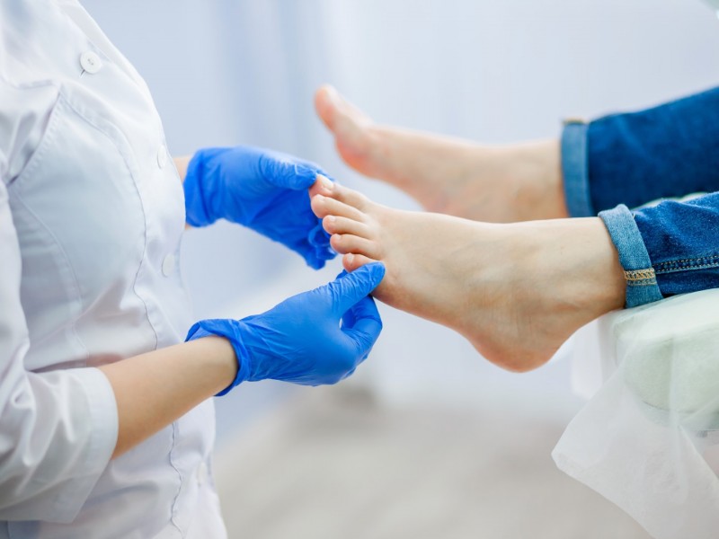 Treatment for Painful Hammertoe