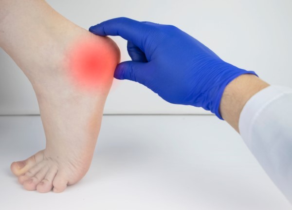 Achilles Heel: It Takes a Podiatrist to Heal the Pain