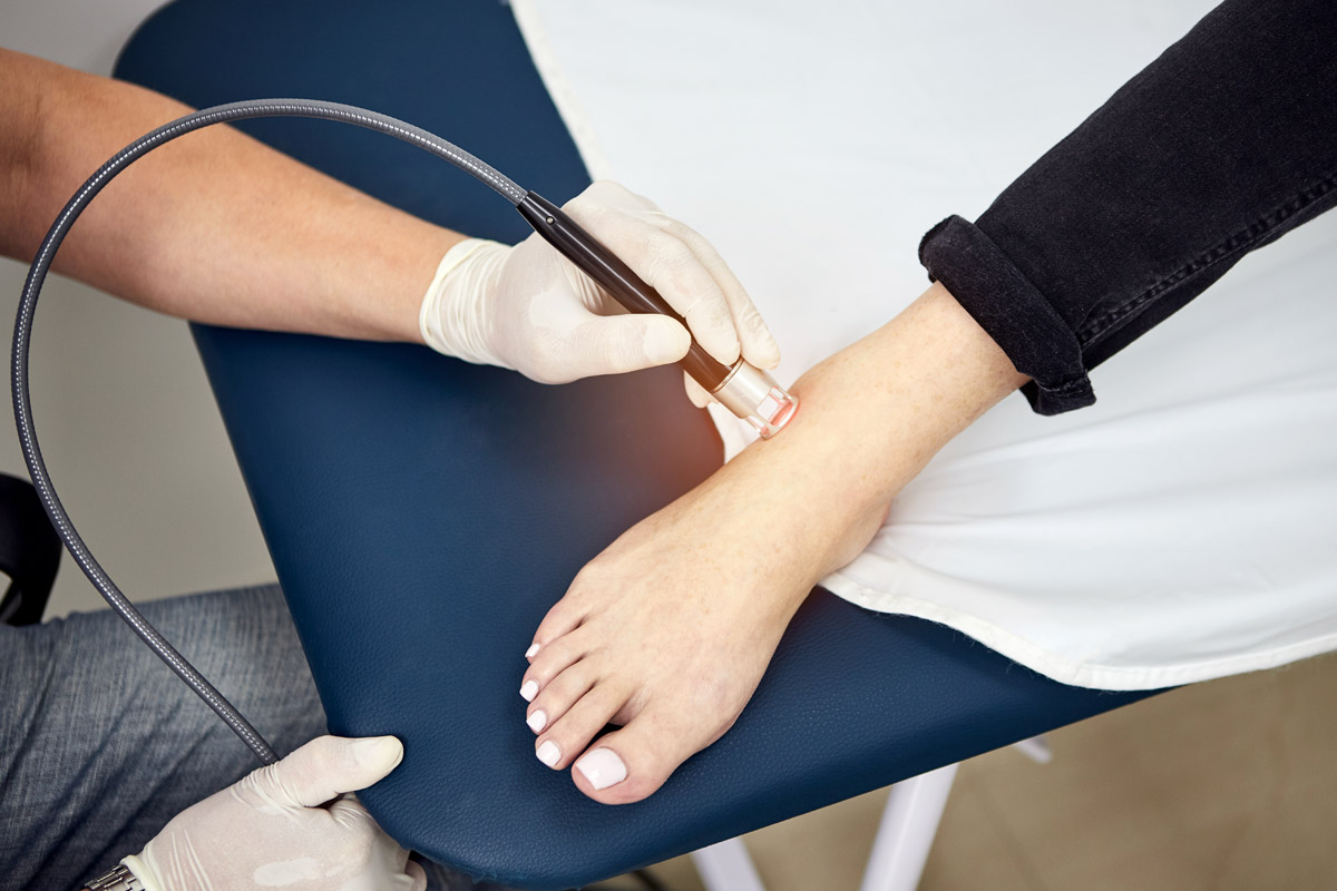 Laser treatments for Foot Pain in Corona Queens